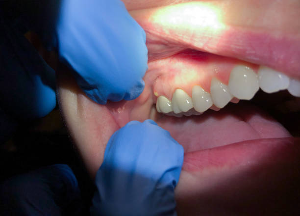 Best Emergency Root Canal Therapy in Columbus, NC